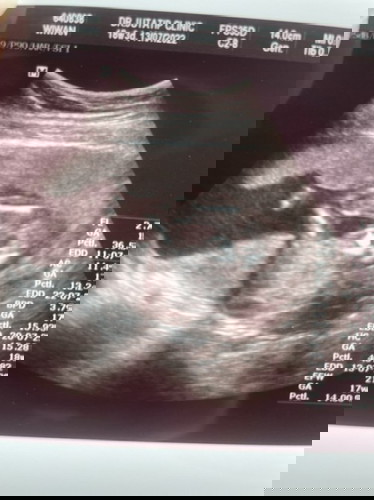 แม่ๆคิดว่าเป็นเพศไหนคะ