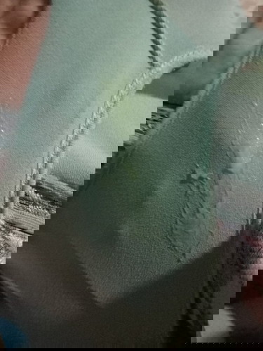 ท้อง38+1ทีมคลอดกุมภาพันธุ์