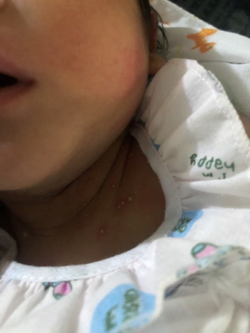 ขอคำปรึกษาหน่อยคะ