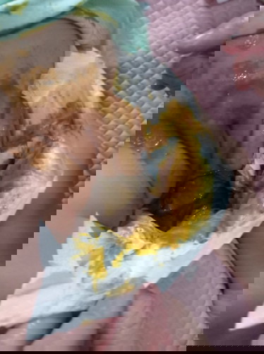 Bun baby saya habis demam 40c kmrn lusa, skrg sdh sembuh cuma pupny jd sangat cair tidak sepeeti bia