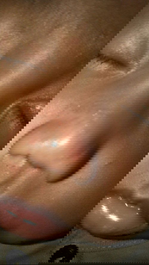 Masalah kulit baby umur 2 bulan