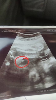 Scan detail 29 weeks