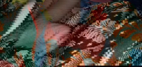 Kaki kiri gatal bintil2 berair