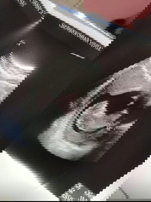 ถามเป็นความรู้ค่ะ