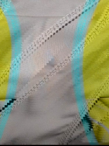 Help! Ano klaseng discharge po ito?