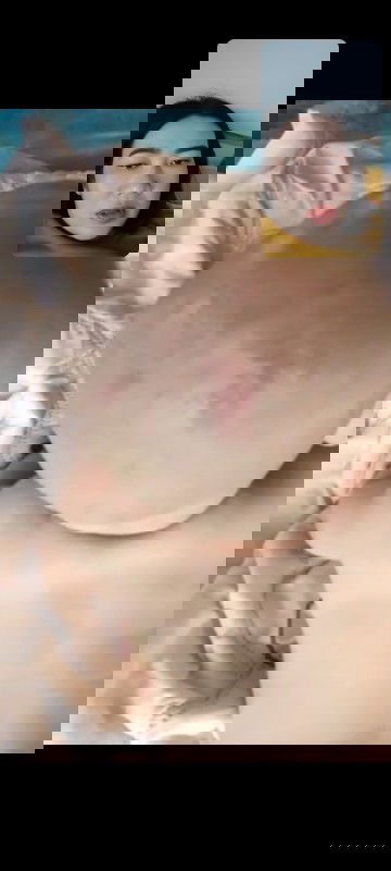 น้องเปนแบบนี้อ่ะค่ะมียาหรือแชมพูตัวไหนแนะนำบ้างค่ะแระหน้าจะ+กับอากาศร้อนด้วย