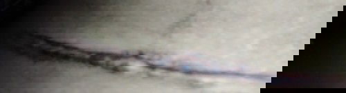 Bun mw tanya donk kalo luka pas SC  begini kira" bahaya tidak ia bun🙏