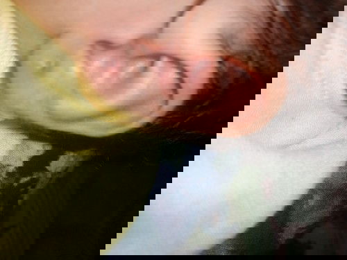 Benjolan di bekas tindik