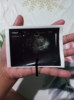 Hi. I am 5 weeks and 3days pregnant. Nagpacheck up ako nung kaka 5 weeks plang ng tiyan ko.