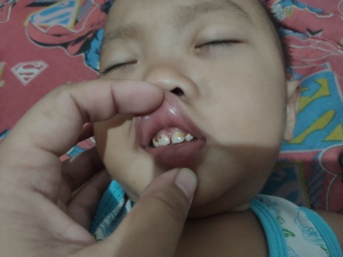 Teeth ni Baby