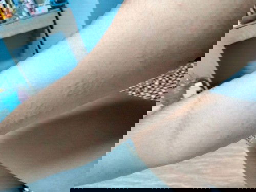 ลมพิษตอนตั้งครรภ์