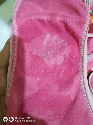 mucus plug
