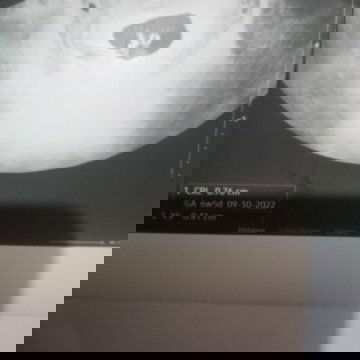 Hi mga ka mommy. first time mom here, 7 weeks and 4 days. Normal lamg po na walang morning sickness?