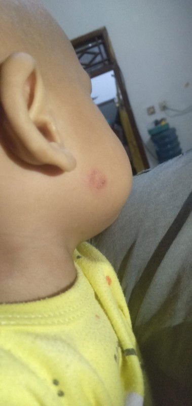 Cara menyembuhkan nya mom²