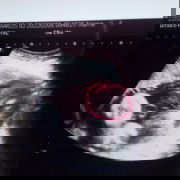 หญิงหรือชายค่ะ