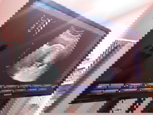 ปกติลูกในครรภ์​ กินอาหารกับแม่โดยตรง ตอนกี่week คะ