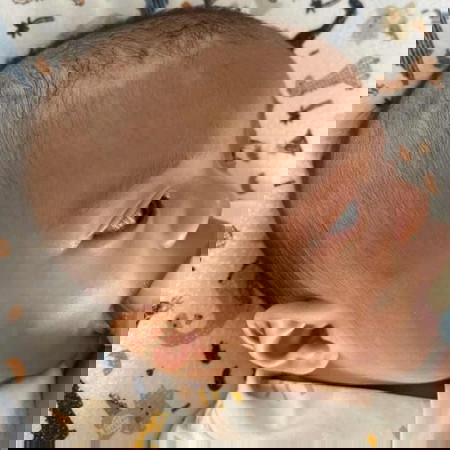 ตรงหัวน้องลอกมีสีขาวๆแบบนี้ ใช้ยาอะไรทาค่ะ