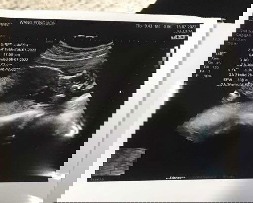 ช่วยดูให้หน่อยจ้ะแม่ๆ