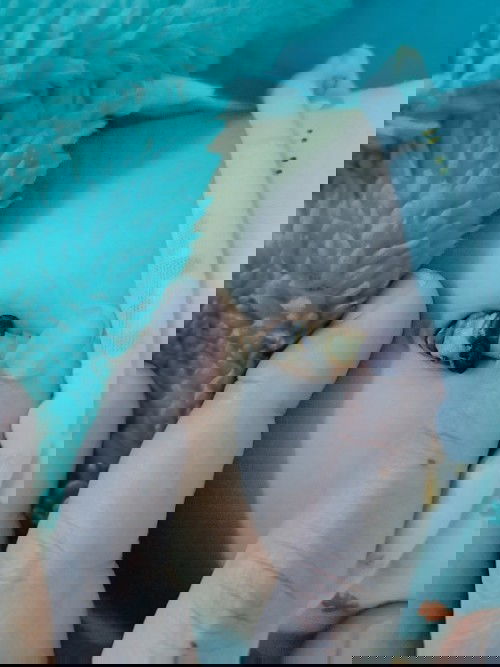 สะดือไม่ยอมหลุด