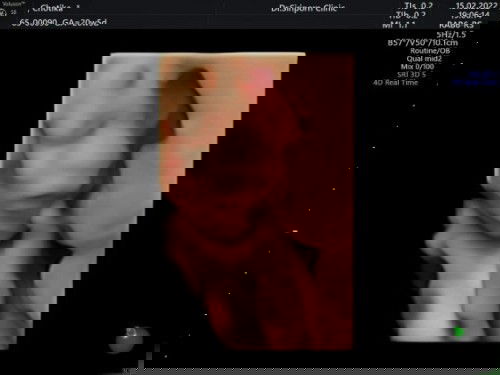 อวดรูปตัวน้อยของคุณแม่หน่อยค้า