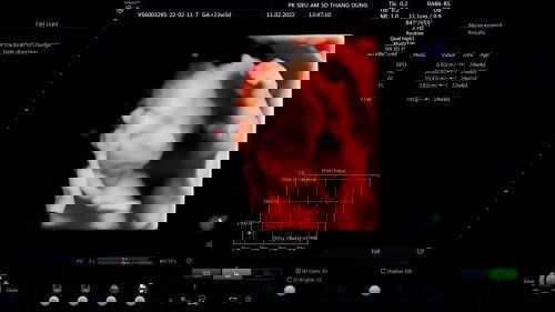 Cọp vàng bé bi🐯