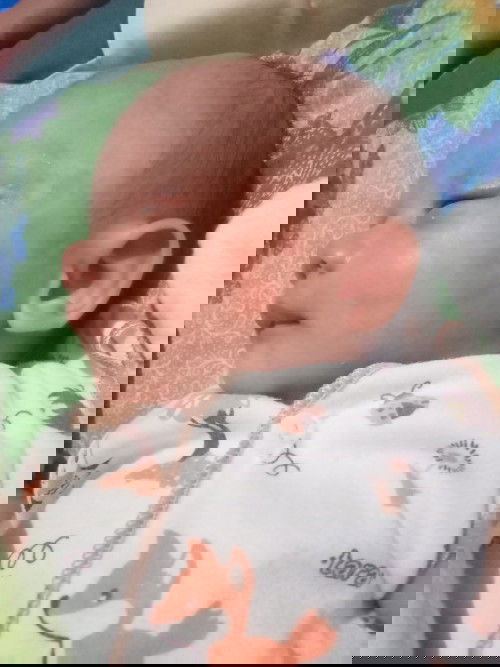 Merah merah pada kulit bayi