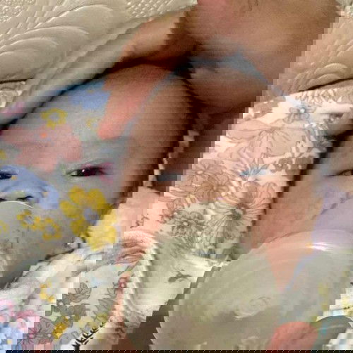 Kemerahan di wajah bayi