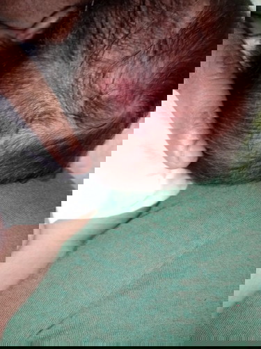 Birthmark po ba itong red
