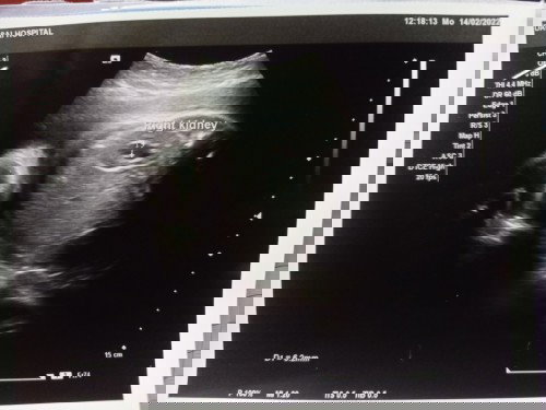 ขอสอบถามแม่ๆหน่อยค่ะ