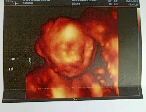 ได้เจอหน้าครั้งแรก