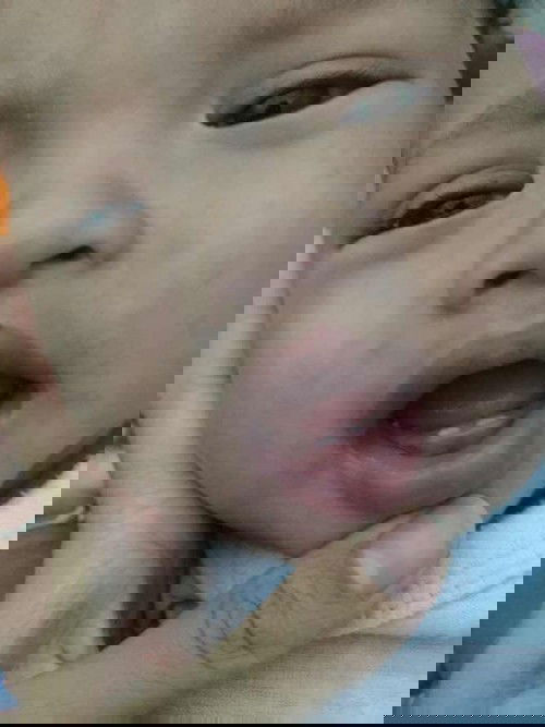 ลูกมีฟันตอน5เดือน