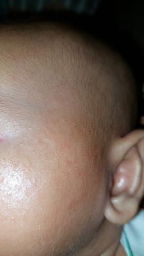Vco buat muka bayi aman ga si? Anakku mukanua di pipi ada bintik2 item dipakein itu boleh ga