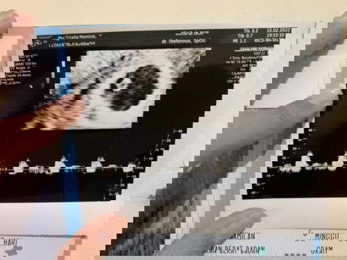 Usia 6w4d keluar flek