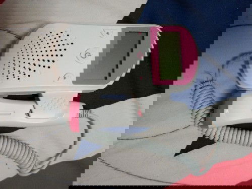 ฟังเสียงหัวใจทารกได้ตอนไหนคะ