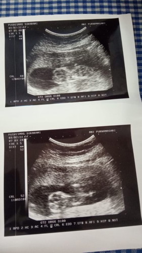 Bentuk usia bayi 4bln