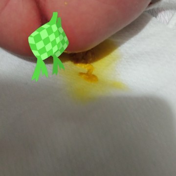 Normal na poops of newborn