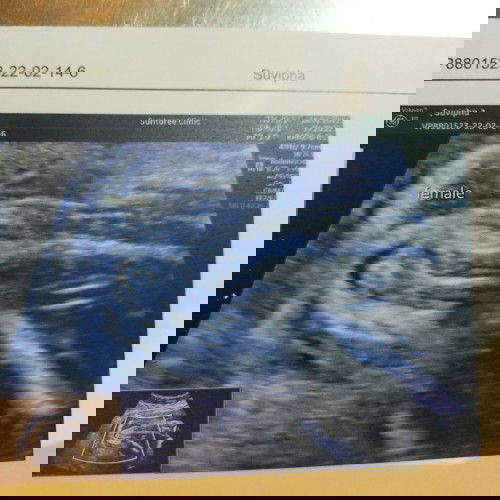 อยากทราบว่าลูกสาว100%ชัวมั้ยคะ