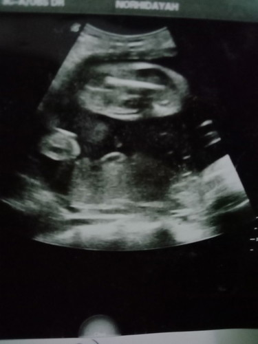 Boy or girl?