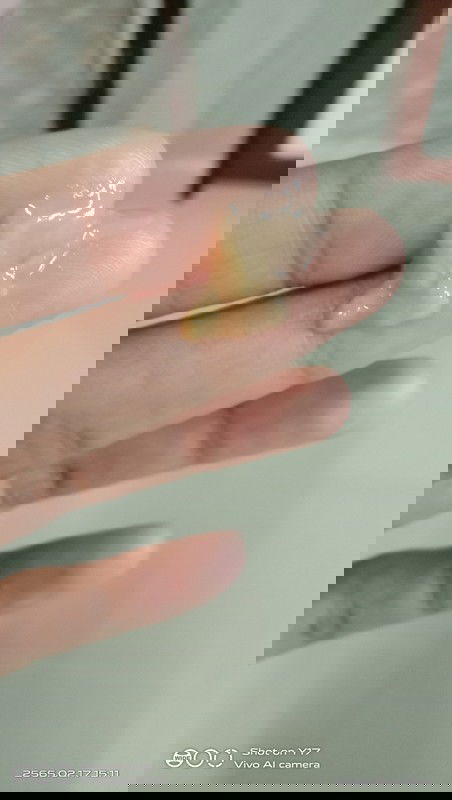 แบบนี้เค้าเรียกว่าตกขาวหรืออะไรค่ะ