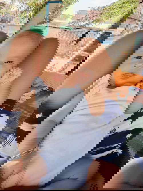 ขอสอบถามหน่อยค่ะเด็ก2เดือนลืมตาม่เท่ากันตาน้องจะเท่ากันมั้ยค่ะ