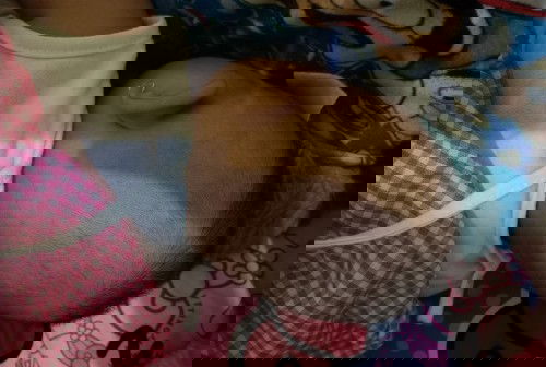 Cara ngembaliin bentuk kepala bayi