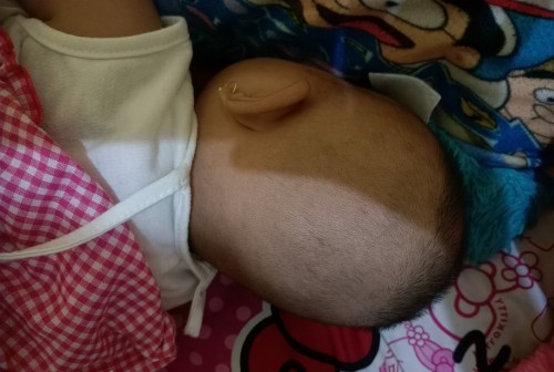 Cara ngembaliin bentuk kepala bayi
