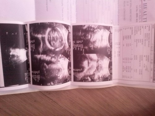 Suhe sya 27 weeks na po sya? Iikot pa po ba? Ano ang dapat gawin? Sana umayos pa po sya.............