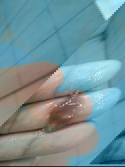 มูกสีนี้ใกล้คลอดรึยั้งคะ