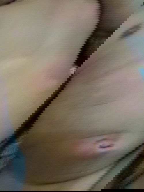 Kulit bayi merah lalu jadi putih melebar