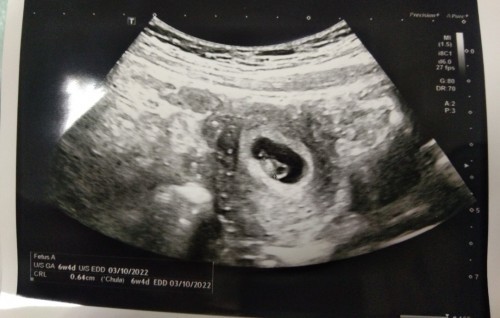 สอบถามแม่ๆหน่อยค่ะ เมนส์มาครั้งสุดท้าย25พ.ย