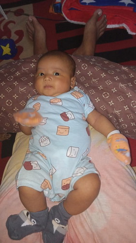 Bayi sering mulet
