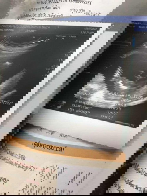 ท้องเเรก❤️🤟 นัดคลอดกค