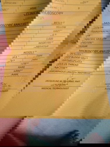 URINALYSIS RESULT