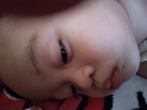 Anak saya demam batuk flu, suaranta hilang, apakah ada yg mengalami hal yg serupa dengan saya 😪🥺